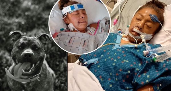 Brutální útok pitbula: Mladá matka přišla o všechny končetiny