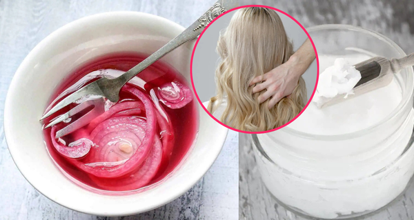 Zázrak z kuchyně: Vyrobte si cibulový olej, který zastaví padání vlasů a podpoří jejich růst!