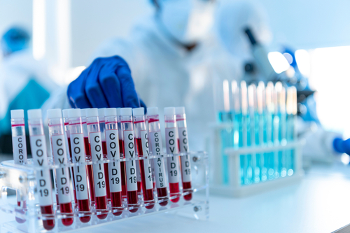 The COVID-19 vaccine is a global public good – Brussels Morning Newspaper